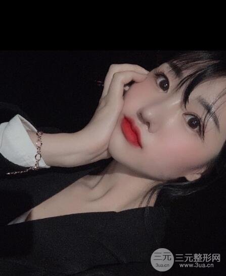 缩鼻头和鼻翼手术后