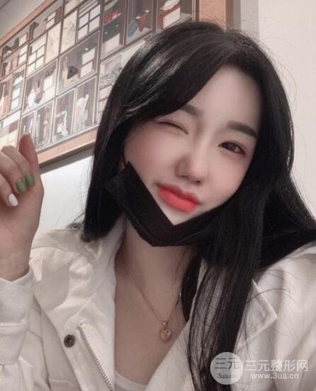 缩鼻头和鼻翼手术后