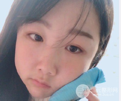 装烤瓷牙有什么后遗症
