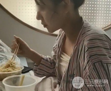 自体脂肪丰胸恢复期多久