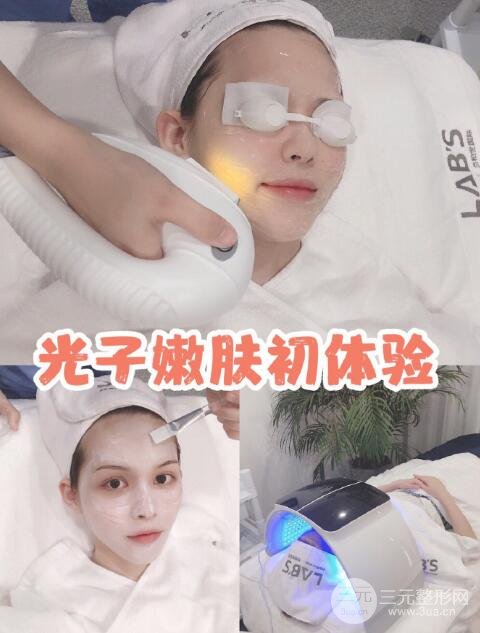光子嫩肤