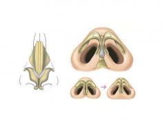 怎么让鼻头缩小？几个小妙招教你变美鼻！