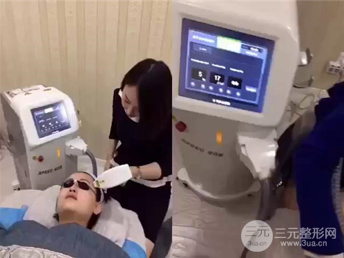 额头激光脱毛多少钱