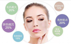 光子嫩肤祛痘印的果不错，痘皮的集美试一下！