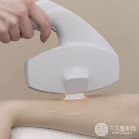 如何能长时间脱毛