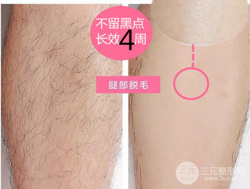 如何能长时间脱毛