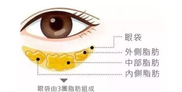 溶脂去眼袋手术维持时间