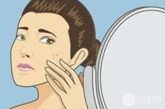 脉冲激光祛痘需要做几次？术后护理怎么做，看完这篇就懂了！