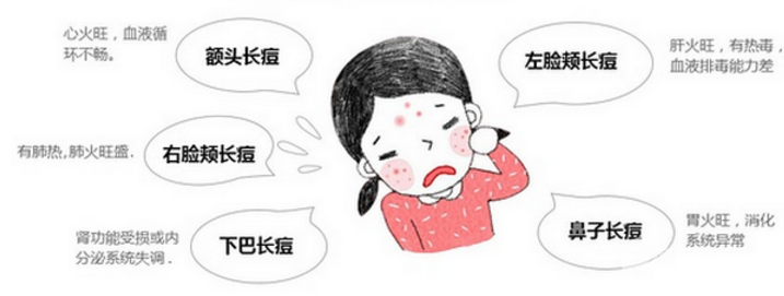 激光祛痘祛斑能同时做吗
