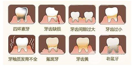 装烤瓷牙能做磁共振吗