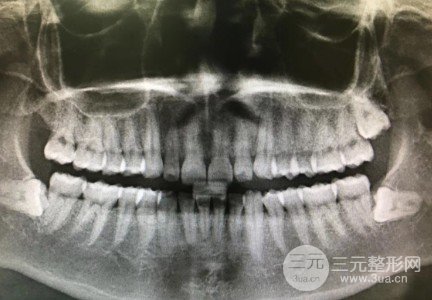 长春科美口腔收费标准