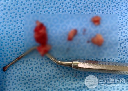 长春科美口腔收费标准