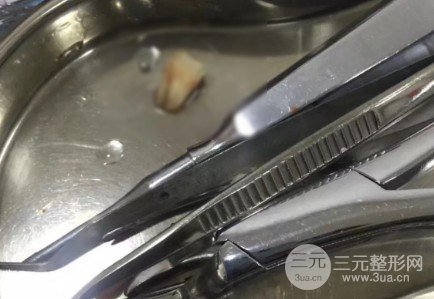 长春科美口腔收费标准