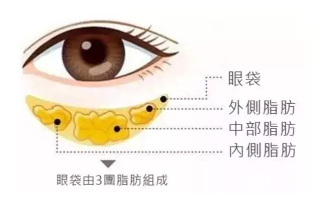 眼袋整形手术有哪些