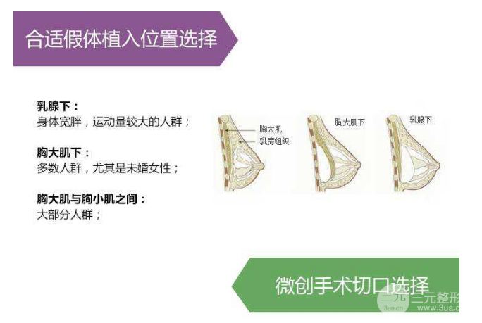 做假体隆胸手术降低风险吗