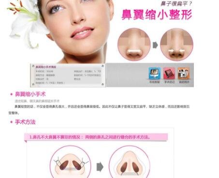鼻翼缩小整形术步骤和原理