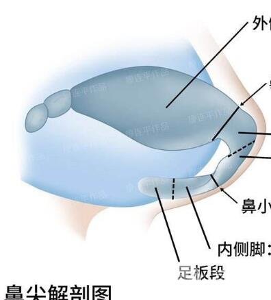 为啥只想隆鼻,医生还让做鼻尖成形术