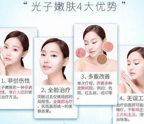 光子嫩肤祛斑的价格