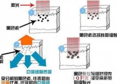 黄褐斑怎么消除？激光果好不好，来了解一下！
