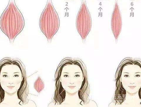 注射瘦脸多长时间见