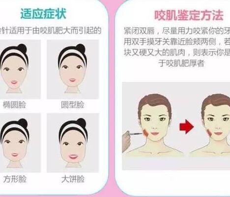 注射瘦脸多长时间见