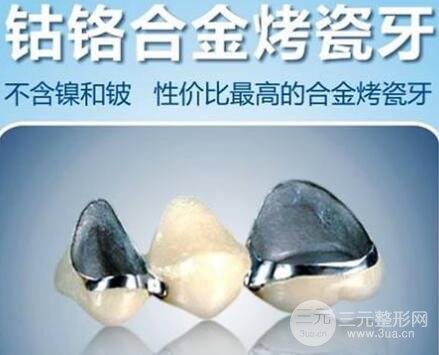 钴铬合金烤瓷牙的优缺点