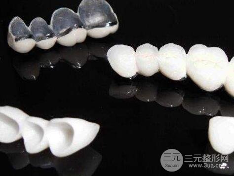 钴铬合金烤瓷牙的优缺点