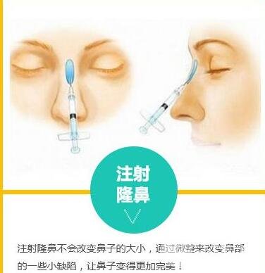 怎么样才能注射隆鼻