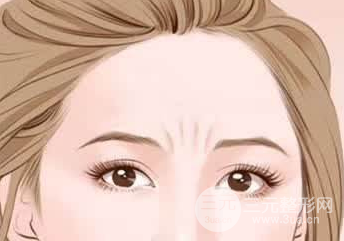 眼角皱纹除皱的方法