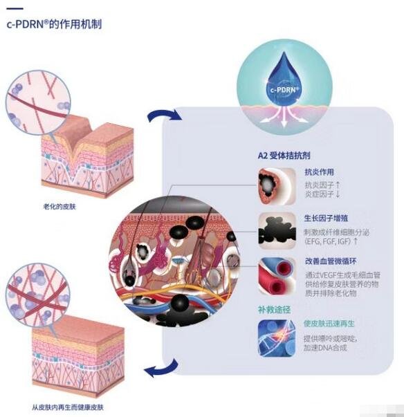 针与注射美白也不一样的