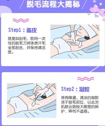 激光脱毛还会再长吗