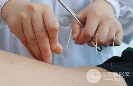 去除面部红血丝的方法