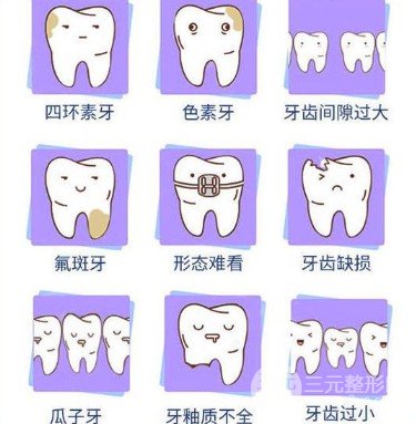 全瓷牙贴面能撑多久