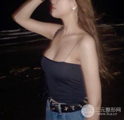 假体隆胸
