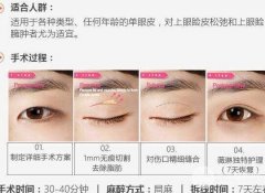 北京割双眼皮多少钱？影响双眼皮手术价格的因素