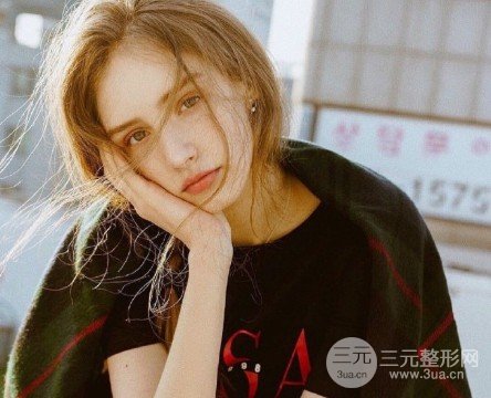 激光双眼皮手术