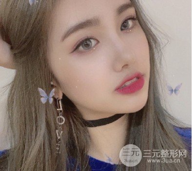 激光双眼皮手术