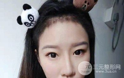 河南植发正规医院收费标准