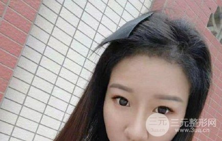 河南植发正规医院收费标准