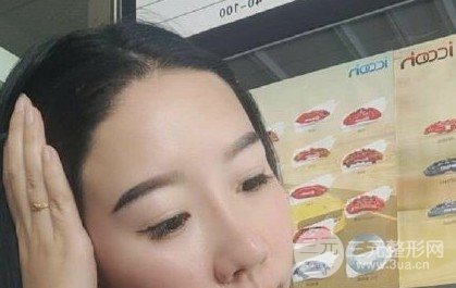 河南植发正规医院收费标准