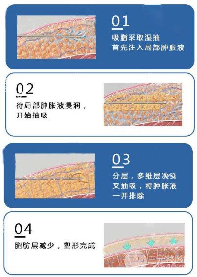 怎样消除双下巴