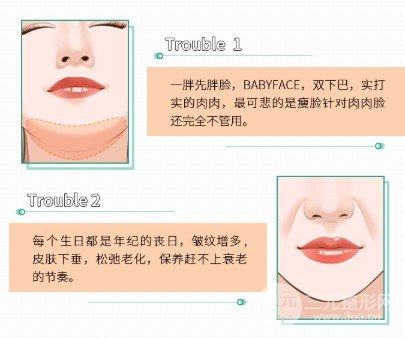 v型脸整形怎么做