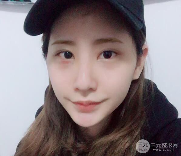 手术后的一星期