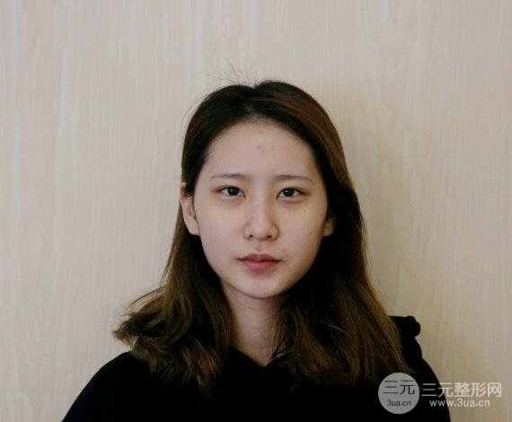 手术后的一星期