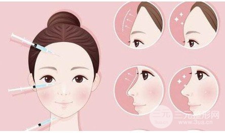 额头整形术前后图片