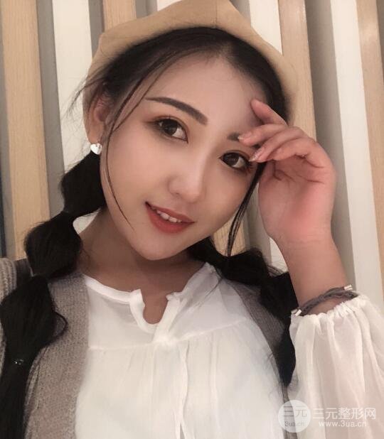 玻尿酸隆鼻手术的恢复过程