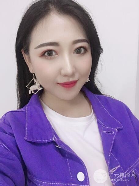 玻尿酸隆鼻手术的恢复过程