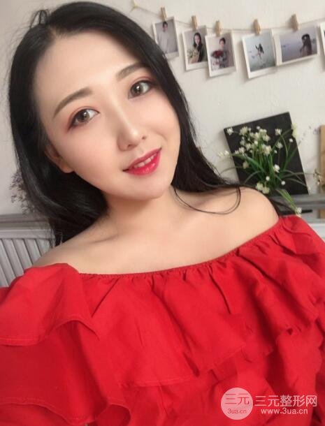 玻尿酸隆鼻手术的恢复过程
