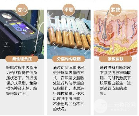 吸脂减肥价格贵不贵