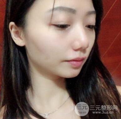 手术前的我